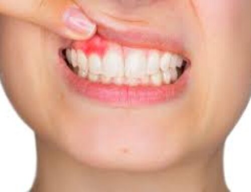 Diabetes and Oral Health – Essential Information and Support for Americans Living With Diabetes